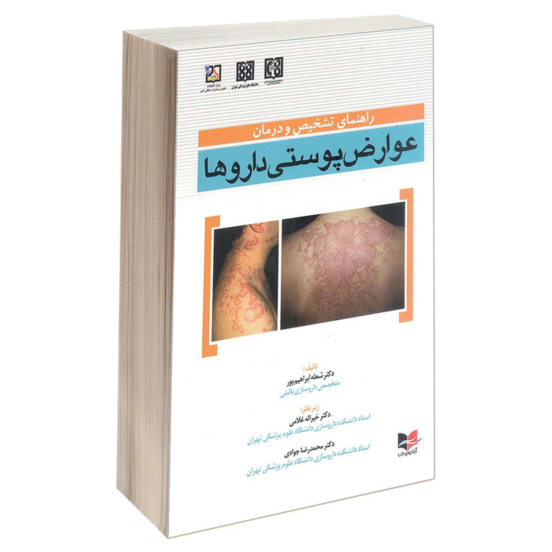 کتاب راهنمای تشخیص و درمان عوارض پوستی داروها اثر دکتر شعله ابراهیم پور انتشارات آبادیس طب